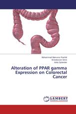 Alteration of PPAR gamma Expression on Colorectal Cancer