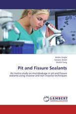 Pit and Fissure Sealants