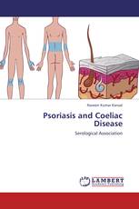 Psoriasis and Coeliac Disease