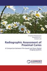 Radiographic Assessment of Proximal Caries
