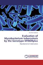 Evaluation of  Mycobacterium tuberculosis by the Genotype MTBDRplus