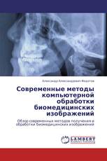 Современные методы компьютерной обработки  биомедицинских изображений