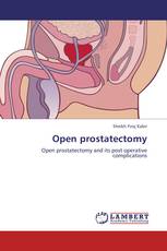 Open prostatectomy