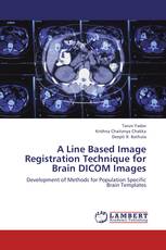 A Line Based Image Registration Technique for Brain DICOM Images