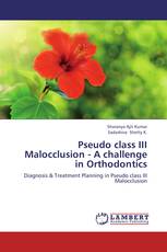 Pseudo class III Malocclusion -   A challenge in Orthodontics