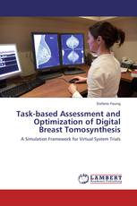 Task-based Assessment and Optimization of Digital Breast Tomosynthesis