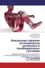Локальная терапия остеоартроза коленных и тазобедренных суставов