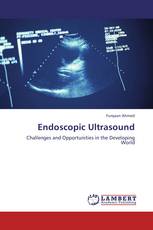 Endoscopic Ultrasound