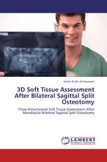 3D Soft Tissue Assessment After Bilateral Sagittal Split Osteotomy
