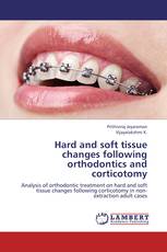 Hard and soft tissue changes following orthodontics and corticotomy