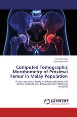 Computed Tomographic Morphometry of Proximal Femur in Malay Population