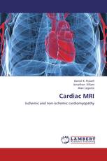 Cardiac MRI