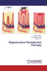 Regenerative Periodontal Therapy