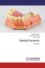 Dental Ceramics
