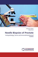 Needle Biopsies of Prostate