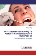 Post-Operative Sensitivity In Posterior Composite Placed Restorations
