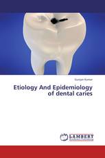 Etiology And Epidemiology of dental caries