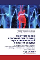 Картирование поверхности сердца   при ишемической болезни сердца