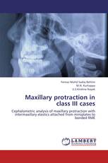 Maxillary protraction in class III cases