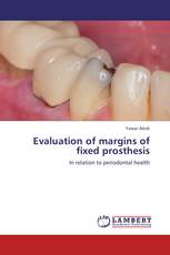 Evaluation of margins of fixed prosthesis