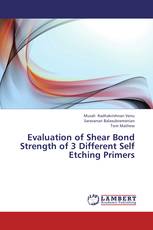 Evaluation of Shear Bond Strength of 3 Different Self Etching Primers