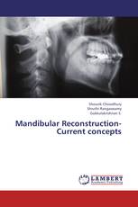 Mandibular Reconstruction- Current concepts