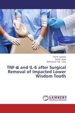 TNF-α and IL-6 after Surgical Removal of Impacted Lower Wisdom Tooth