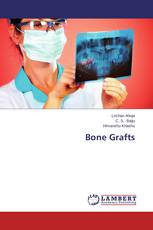 Bone Grafts