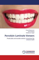 Porcelain Laminate Veneers