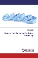 Dental Implants in Pediatric Dentistry