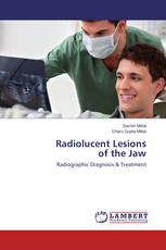 Radiolucent Lesions of the Jaw