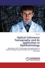Optical Coherence Tomography and its application in Ophthalmology