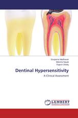 Dentinal Hypersensitivity