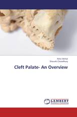 Cleft Palate- An Overview