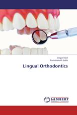 Lingual Orthodontics