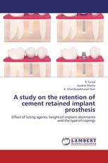 A study on the retention of cement retained implant prosthesis