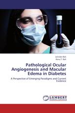 Pathological Ocular Angiogenesis and Macular Edema in Diabetes