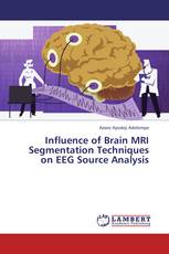 Influence of Brain MRI Segmentation Techniques on EEG Source Analysis