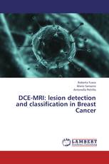 DCE-MRI: lesion detection and classification in Breast Cancer