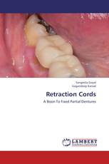 Retraction Cords