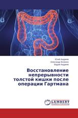 Восстановление непрерывности толстой кишки после операции Гартмана