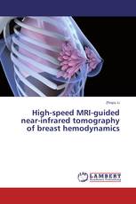 High-speed MRI-guided near-infrared tomography of breast hemodynamics