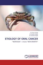 Etiology of Oral Cancer
