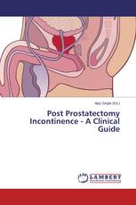 Post Prostatectomy Incontinence - A Clinical Guide