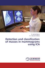 Detection and classification of masses in mammograms using ICA
