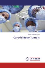 Carotid Body Tumors