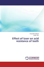 Effect of laser on acid resistance of teeth