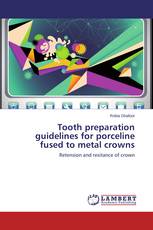 Tooth preparation guidelines for porceline fused to metal crowns