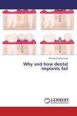 Why and how dental implants fail