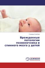 Врожденные патологии позвоночника и спинного мозга у детей
